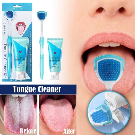 Tongue cleaner